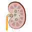 /Kidney%20Stones